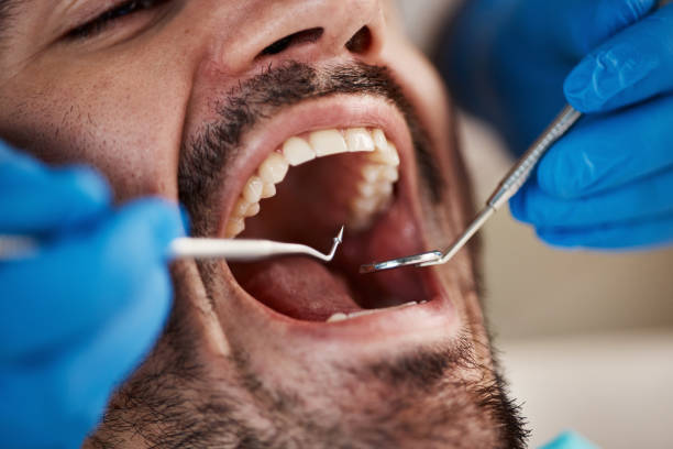 Best Emergency Wisdom Teeth Removal in Augusta, AR